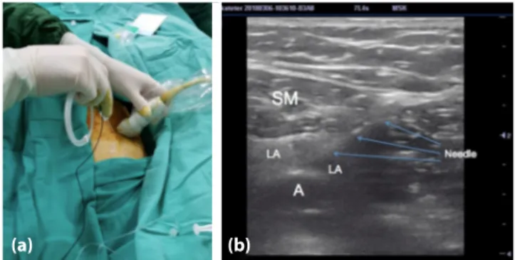 Figure 1. (a) Position of the ultrasound probe and needle during 