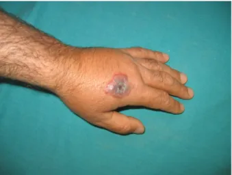 Figure 5. Distribution of treatments.