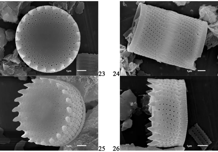 Figure 4. 23–26 – Aulacoseira pusilla (Meister) Tuji &amp; Houk, all SEM. Scale bars: 1 µm.