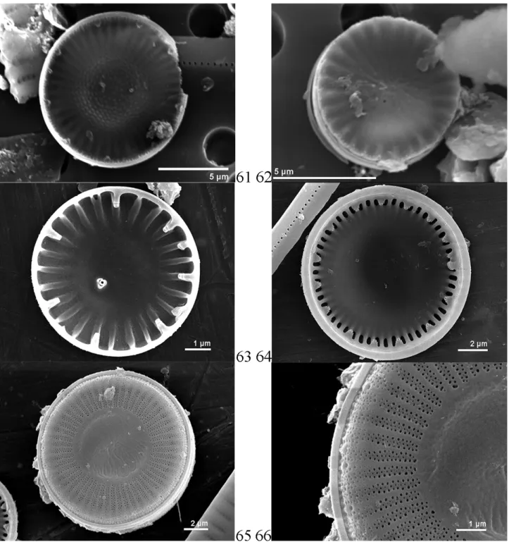 Figure 6. 61 – Cyclostephanos dubius (Hustedt) Round (internal view); 62, 63 – C. atomus Hustedt (62 – external view, 63 – internal  view); 64–66 – C