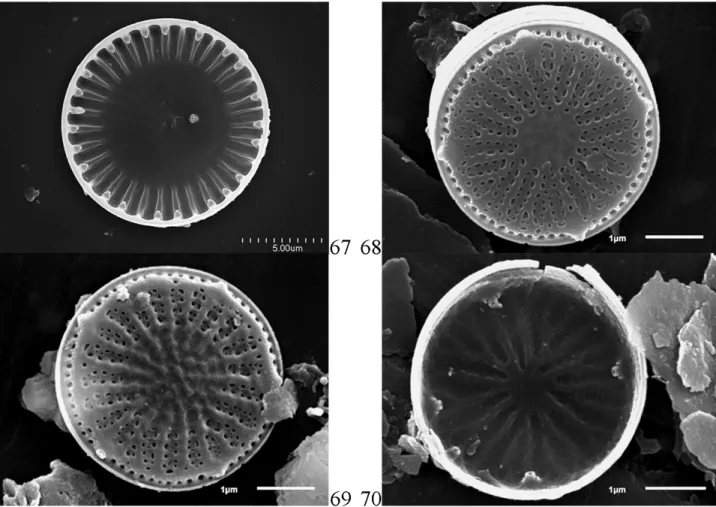 Figure 7. 67 – Cyclotella meneghiniana Kützing (internal view); 68–70 – D. pseudostelligera (Hustedt) Houk &amp; Klee (68, 69 – external  view; 70 – internal view); all SEM