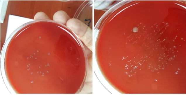 Şekil 4.1. 25 – 26 numaralı Arcobacter’lerin kanlı agar üzerindeki görüntüsü. 