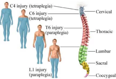 Şekil  2.5.  Omurilik  hasarının  meydana  geldiği  bölgeye  göre  vücutta  etkilenen  bölgeler  (http://www.nettedavi.com/SayfaDetay/Omurilik-Yaralanmalari/472/)