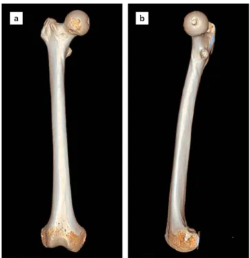 Figure 1. Anteroposterior (a) and lateral (b) images of the femur after 3D reconstruction of the CT images obtained by Leonardo Dr/Dsa Va30a software (Siemens ® , Erlangen, Germany)