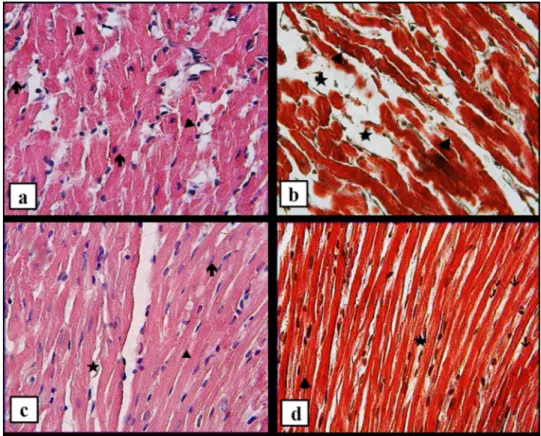 FIGURE 1. H&amp;E and Masson’s Trichrome staining of the experimental groups. (a,b) IR group showing disorganization of cardiac muscle fibers (arrowhead), morphology deformation of nuclei (arrow), edematous areas in the connective tissue (star); (c, d) hep