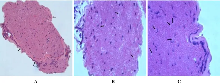Fig. 2. The damages of  aorta tissue   of the animals in diabetic control group.   D. Loss of elastic fibers and defects in 