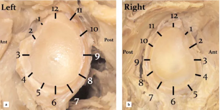 Figure 2. Clock positions of the left (a) and right (b) glenoid labrum. [Color figure can be viewed in the online issue, which is available at www