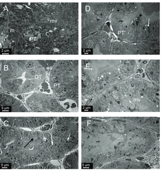 Figure 5 Ultrastructure of tubules in experimental groups. Lysosomes (white arrow) and karyolitic nuclei (black arrow) in the SeD  group