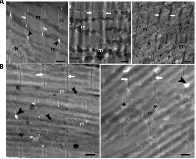 Fig. 1    The electron microscopy analysis of left ventricular cardio- cardio-myocytes incubated with a  Zn 2+ -ionophore,   Zn 2+ -pyrithione, ZnPT  (0.01-μM, 0.1-μM, or 1-μM for 1-h) (A; left, middle, right,  respec-tively), with 10-μM  ZnPO 4  (1-h; B, 