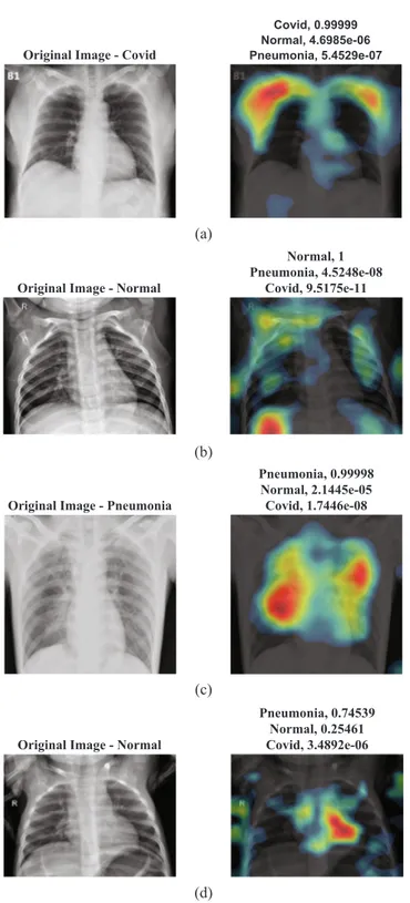 Fig. 12. Class activation mapping visualization of the proposed deep Bayes- Bayes-SqueezeNet on sample images: a) Covid b) Normal c) Pneumonia d) Misclassi ﬁed prediction.