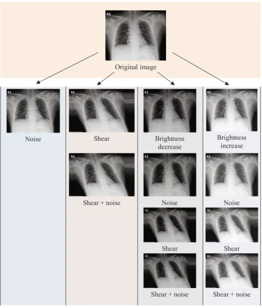 Fig. 6. O ﬄine augmentation: A demonstration on original image.