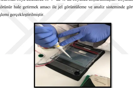 ġekil 3.1 0 . Ribozomal DNA‘lar PCR yöntemi ile çoğaltılmasından sonra elde edilen  DNA fragmentlerinin elektroforez yapılması 
