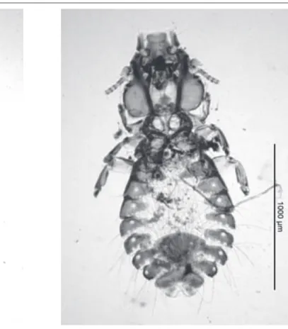 Şekil 2. Philopterus sittae, dişi, orijinal Fig 2. Philopterus sittae, female, original      