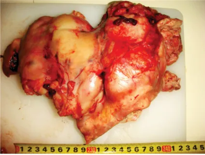 Figure 1. Soft and yellowish colored pulmonary mass.