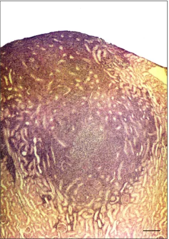 Fig. 1. Tuberculous foci in the cortex of kidney. HE,  Bar=200µm 