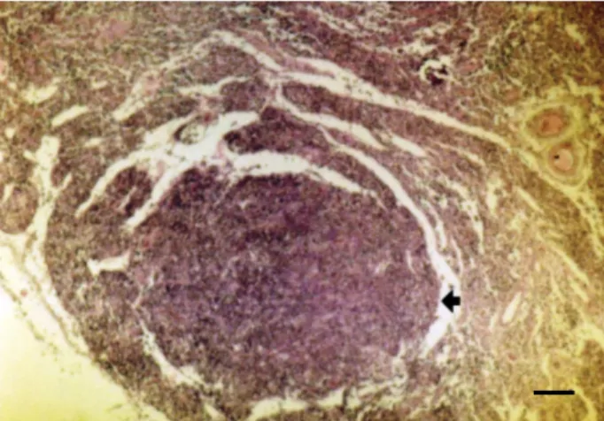 Fig. 2. Tuberculous foci in the mediastinal lymph node  (arrow). HE, Bar=200 µm 