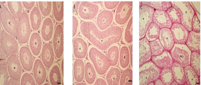 Figure 1. The general appearance of the testis section. A: Control group, B: Sham group, C: CAP group; st: tubulus seminiferus  contortus, L: Leydig cells