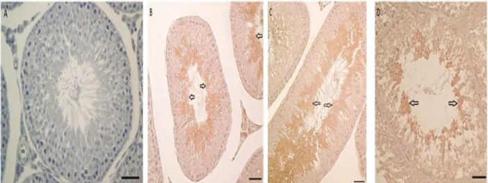 Figure 3. The TGFβ2 gene expression in the testis tissue of rats receiving capsaicin  during puberty