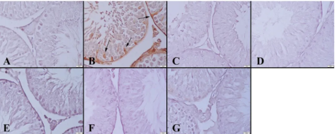 Figure 4. Caspase-3 immunoreaction in testes between the groups. (A) Negative  immunoreaction in Group I, (B) Marked expression in Sertoli cells (arrows) in Group II,  negative expression in (C) Group III, (D) Group IV, (E) Group V, (F) Group VI and (G)  G