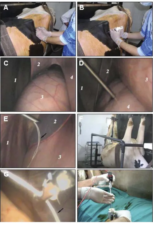 Şekil 2. LDA olgularında uygulanan  laparoskopik abomasum repozisyonu  ve Toggle pin fikzasyonunun aşamaları