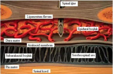 Şekil 2.6. Spinal iğne ile epidural boşluğa giriş yapılması (63). 