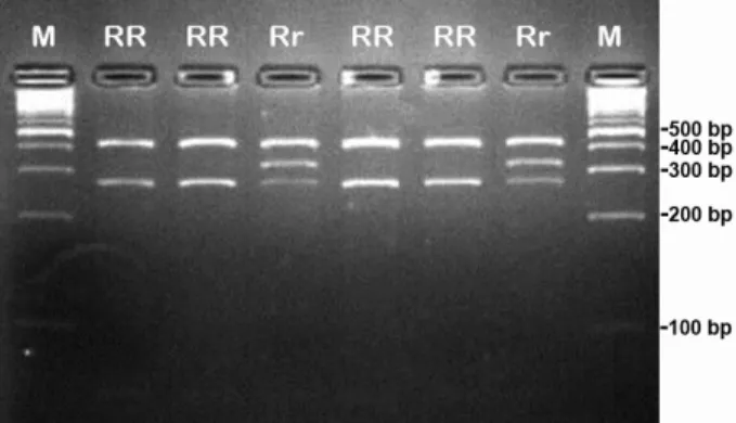 Figure 2. Gel image for the MTNR1A genotypes by PCR-RFLP  analysis. Lane M, molecular marker (100-bp DNA ladder).