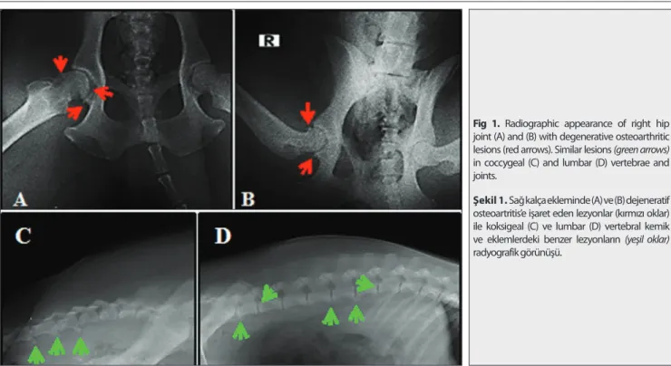 Fig 1. Radiographic appearance of right hip  joint (A) and (B) with degenerative osteoarthritic  lesions (red arrows)