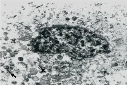 Fig 6. The free mature virion in the cytoplasm of epithelial cell in the CAM of 10 days old SPF embryos chicken egg (arrows), Transmission electron microscope, X 11.500