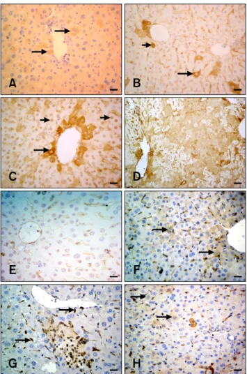 Fig. 3. PCNA, TNFα, and FGF-2 immunohistochemistry in  hepatocytes from the experimental and control groups