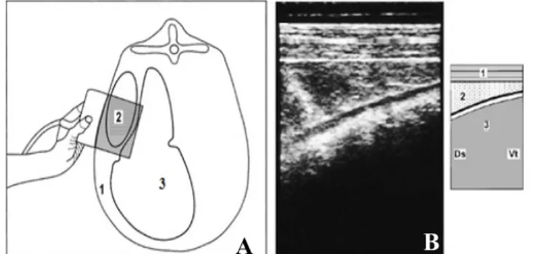 Şekil 2.6. İnterkostal aralıktan ultrasonografinin uygulanışı (A) ve ultrasonografik görüntüsü (B) (1: sol interkostal karın duvarı, 2: abomasum, 3: rumen) [Braun (2002)’dan alınmıştır].