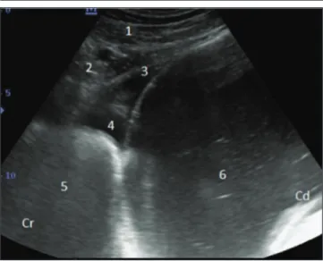 Fig 2. Ultrasonogram of reticulum and abomasum in a cow with  Anterior abomasal displacement imaged from the left sternal region