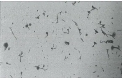 Şekil  3.2.  Anne  sütünden  izole edilen laktik asit bakterilerinin gram boyama görüntüsü