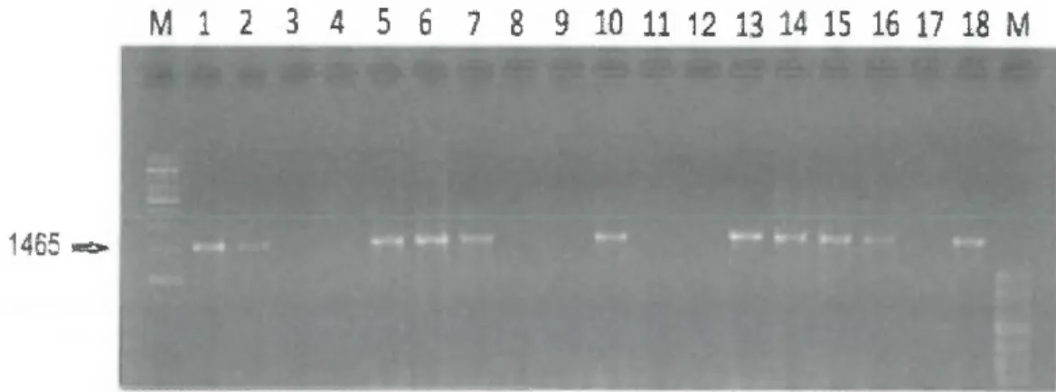 Şekil 3.3.  Aııne sütünden izole edilen laktik asit  bakterilerinin  (1-18. izolatlar)  16S  rRNA  PCR ile çoğaltılması sonucu  elde  edilen  agaroz  jel görüntüsü