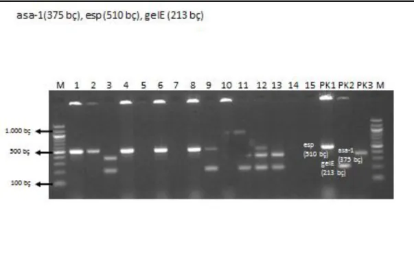 Şekil 4. 4. asa-1 (375 bç), esp (510 bç), gele (213 bç) genlerinin görüntüsü 