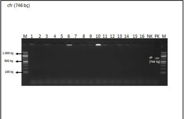 Şekil 4. 6. cfr (746 bç) geninin görüntüsü 