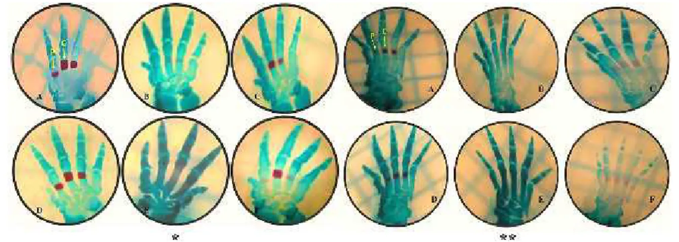 Figure 1. Images of the bones of the hands and feet. (A) Control group. (B) Low-dose nicotine group