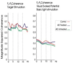Table 1 Summary of event related oscillation studies in AD with a comparison to controls
