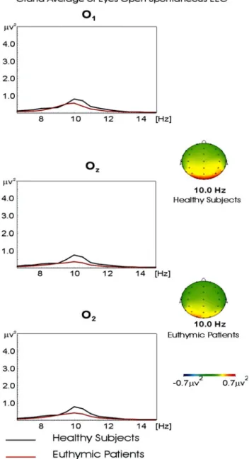 Figure 1 shows the grand averages of power spectrum of the alpha frequency range in occipital locations (O 1 , O z , and O 2 ) in 18 healthy and 18 euthymic bipolar participants for the eyes open condition