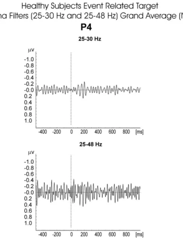 Fig. 10. Flow of information in the auditory, somatosensory and visual pathways, reticular formation, limbic system and association areas of the cortex (sensory and cognitive neural pathways in thisﬁgure are modiﬁed from Flohr (1991 Theory and Psychology 1