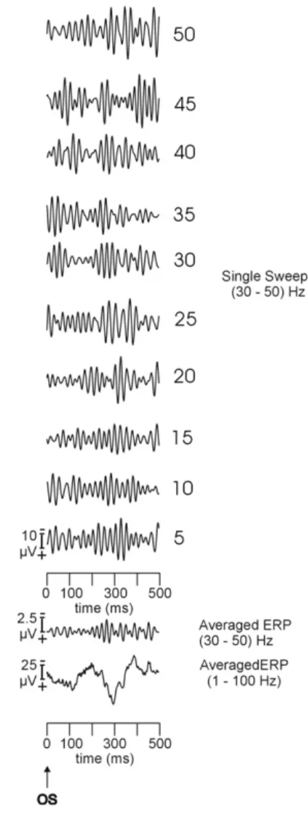 Fig. 3A illustrates the grand average of time –frequency planes show- show-ing the inter-trial coherence of gamma responses in both stimulations (target and simple light) at F 4 location
