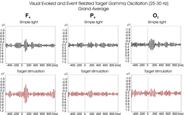 Fig. 7 represents the grand average of ERPs ﬁltered in 30–35 Hz of 13 subjects for F 4 electrode position