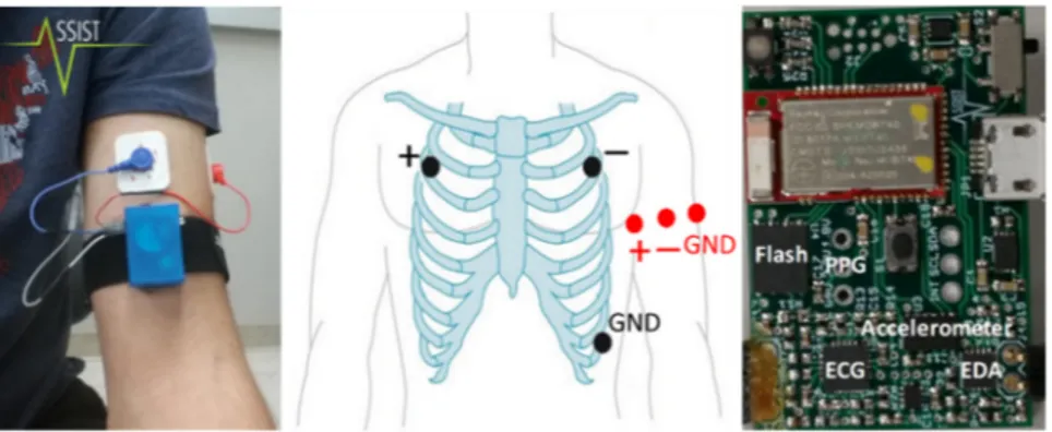 Figure 1. ECG armband (left); arm and chest electrode positions (middle); system hardware (right)