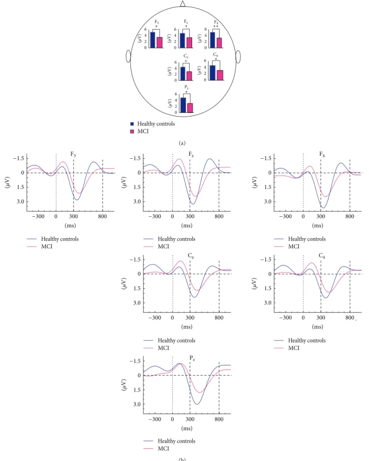 Figure 2: Histograms and grand averages of oscillatory delta (0.5–2.2 Hz) responses. (a) Histograms of mean grand averages of F 3 , F z , F 4 , C z , C 4 , and P z electrode sites in delta (0.5–2.2 Hz) frequency range for 300–800 msec poststimulus