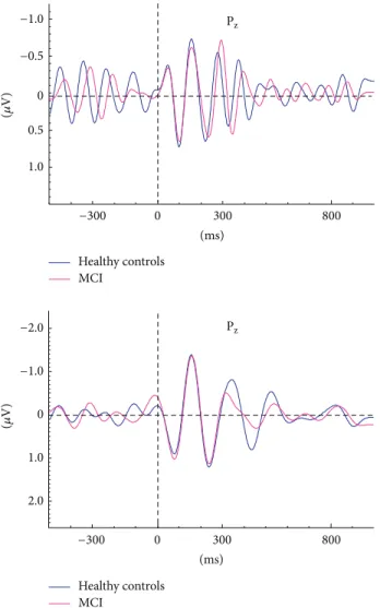 Figure 5: Grand averages of alpha (8–13 Hz) and theta (4–7 Hz) oscillatory responses of healthy control subjects (