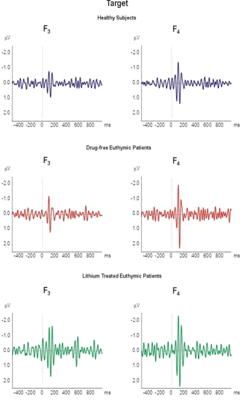 Fig. 16. Examples from each group showing single sweeps to the target stimuli elicited by a classical visual oddball paradigm recorded from F 3 scalp electrode