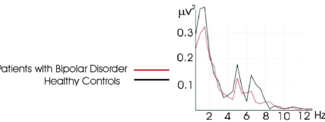 Fig. 6. Grand average of power spectra of auditory evoked (A) and event-related (target) responses (B) over left frontal (F 3 ) location