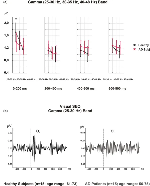Fig. 1. a) Visual gamma SEO responses reveal higher amplitude values in healthy controls with a FR × TW × LAT × GROUP interaction-effect over the left hemisphere, in a 25–30 Hz frequency range, and over a 0–200 ms time window (*p b 0.05)
