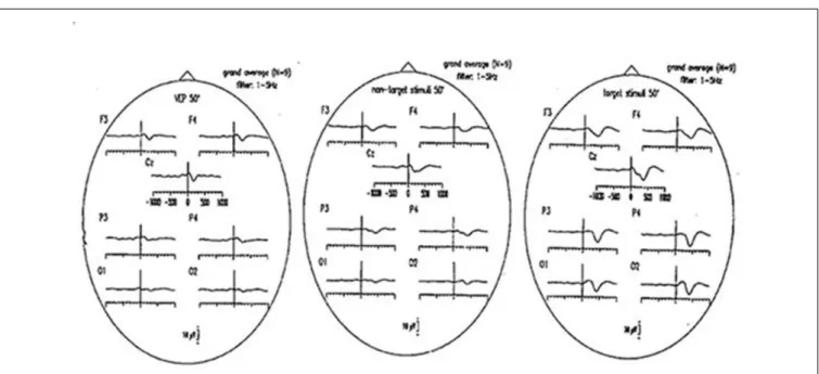 Figure 4 illustrates visual evoked potentials with non-target and target responses as grand average of nine subjects
