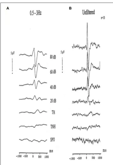 FIGURE 9 | Grand average auditory evoked potentials recordings of ten subjects (vertex)
