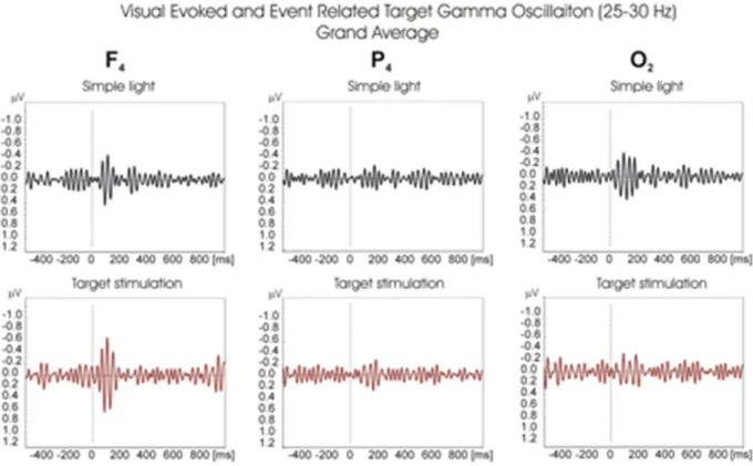 Fig. 9. Grand average of ﬁltered (25–30 Hz) gamma oscillatory responses of 13 subjects for F 4 , P 4 and O 2 electrodes upon application of target (red line) and simple light (black line) stimulation.